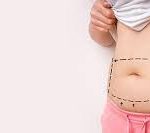 Abdominoplastie : indications, technique chirurgicale et résultats